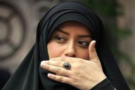 پاسخِ الهام چرخنده، به‌پرسش‌ها درباره‌ی «جراحی زیبایی»اش